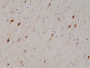 Immunohistochemical