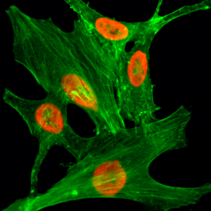 Immunocytochemical