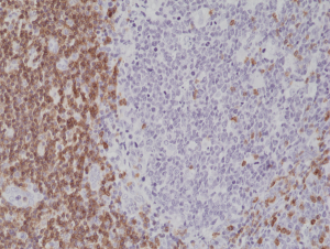 Immunohistochemical