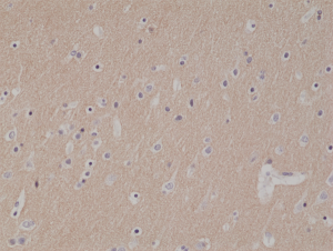 Immunohistochemical