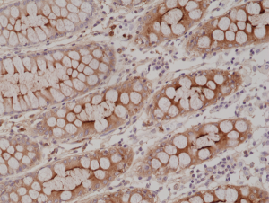 Immunohistochemical