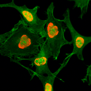 Immunocytochemistry