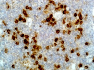 Immunohistochemical