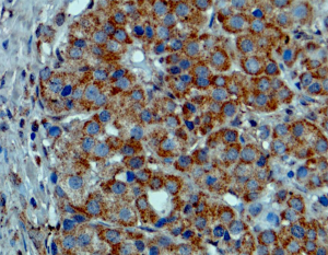 Immunohistochemical