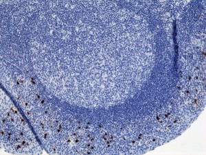 Immunohistochemistry