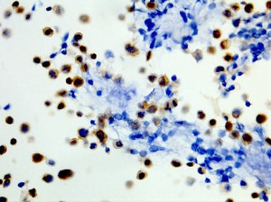 Immunohistochemical